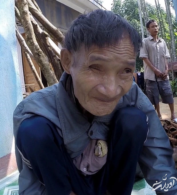 مرد 46 ساله ویتنامی ملقب به تارزان که سال ها در جنگل زندگی کرده، هیچ شناختی از زن ها نداشته و ذره ای میل جنسی در او دیده نمی شود